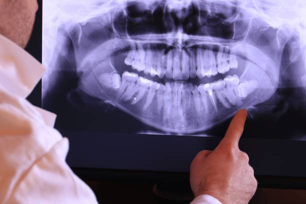 Best Emergency Dental Services for Seniors in Granite Falls, NC